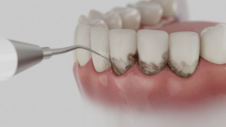Trusted Dental Crowns And Bridges service in Coquille, OR - Dentist Open Now